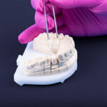 Ästhetische Zahnheilkunde in der Zahnarztpraxis Zahnliebe in Wetter Volmarstein