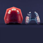 Ganzheitliche Zahnsanierung bei Zahnliebe in Wetter Volmarstein